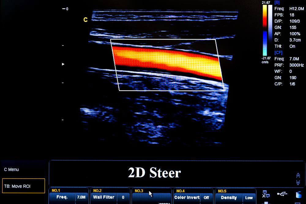 Echocardiography Tests conducted by Dr. Brajesh Kumar Kunwar at Seawoods in Navi Mumbai